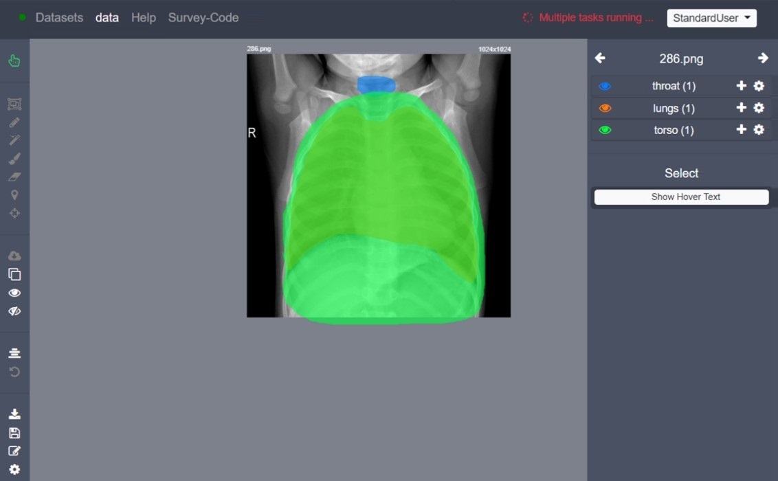 Annotator Software wird benutzt um bei brainiacs GmbH Bilder zu annotieren.